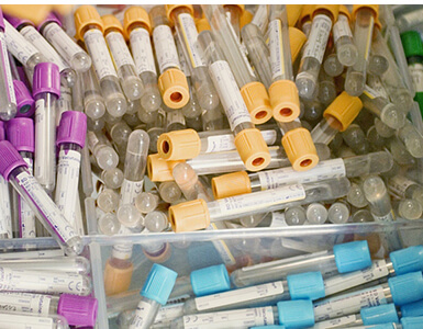 Medical Molding Solution - Test Tube Line